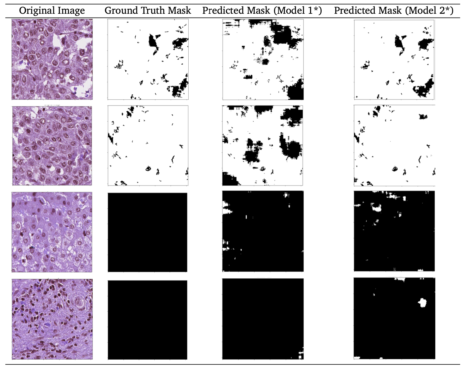 Tissue patches beside reference and predicted tumour masks.
